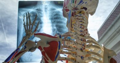 Disturbi muscolo-scheletrici sul lavoro: Catania protagonista con il progetto europeo Prevent4Work