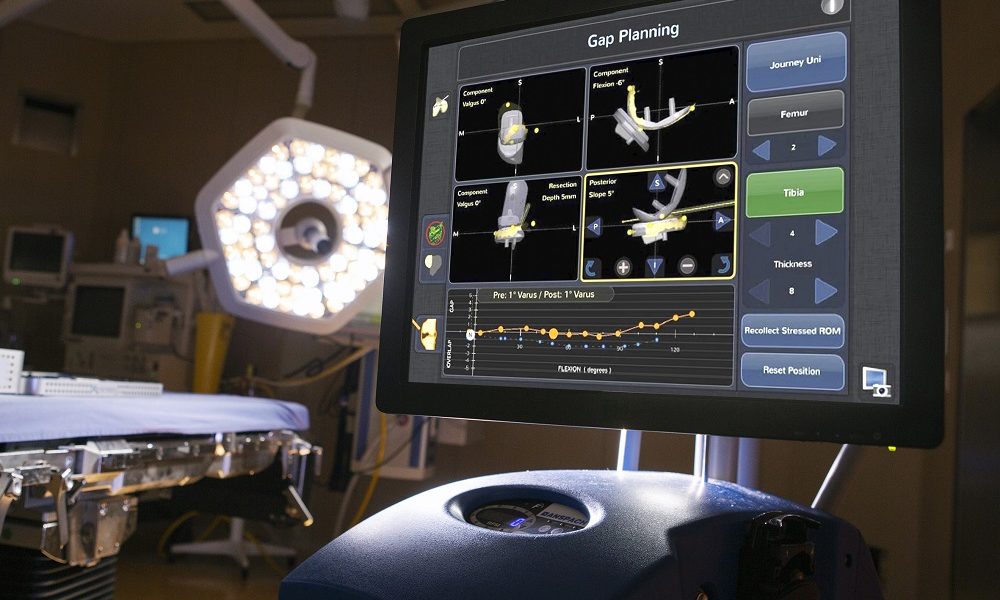 Un robot nell’équipe ortopedica: a Roma il centro di riferimento per la chirurgia ortopedica robotica