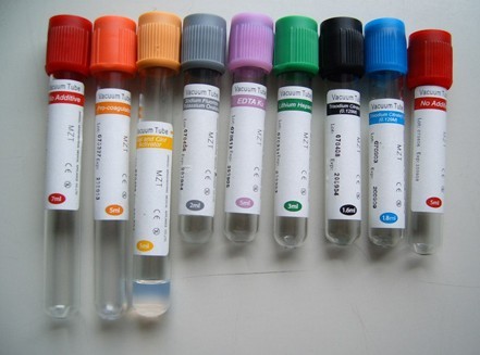 I Colori delle provette: Blu, Rosso, Verde, Viola, Rosa, Nero, Giallo, Grigio