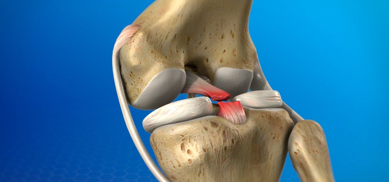 Legamento crociato anteriore 'fondamentale per le attività