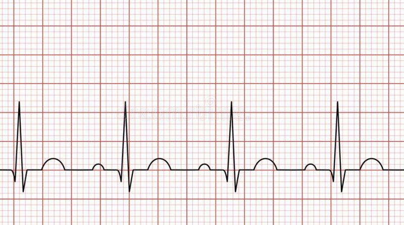 Prime linee guida cardiologi per diagnosi  con holter ed ECG più sicure 