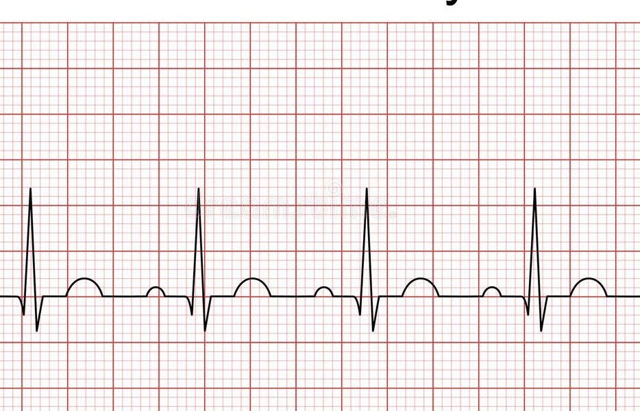 Prime linee guida cardiologi per diagnosi  con holter ed ECG più sicure 