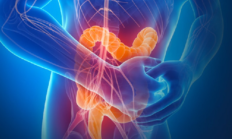 Malattie infiammatorie croniche intestinali (MICI), la nutrizione enterale esclusiva porta alla remissione dei sintomi della malattia di Crohn nell'80% dei casi