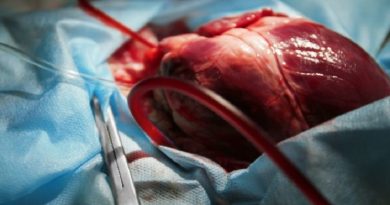 Un cuore per tre: eseguito negli Usa l'innesto di un organo già trapiantato in precedenza