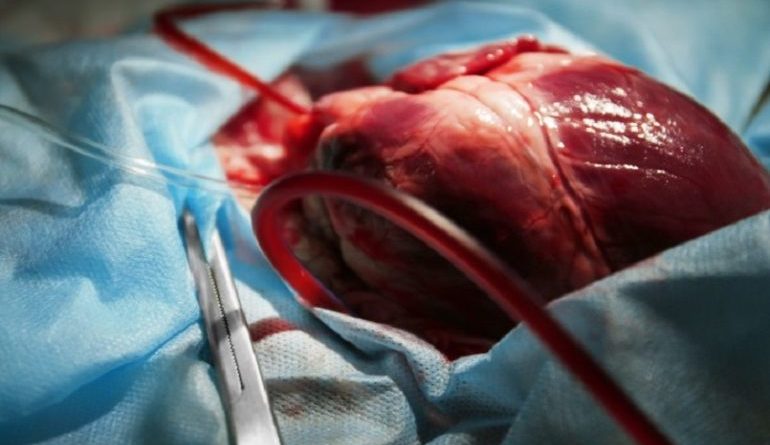 Un cuore per tre: eseguito negli Usa l'innesto di un organo già trapiantato in precedenza