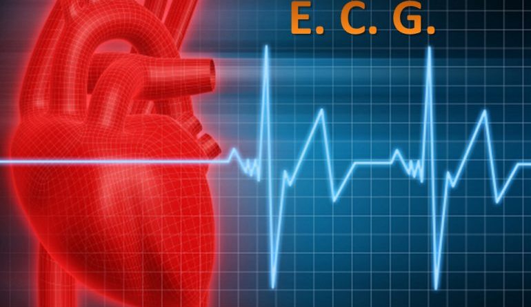Corso Ecm Fad gratuito di elettrocardiografia per infermieri